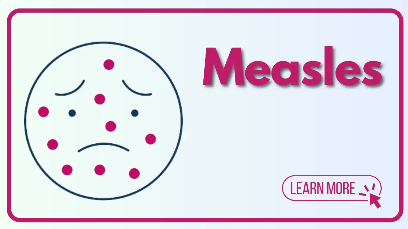 Measles Info