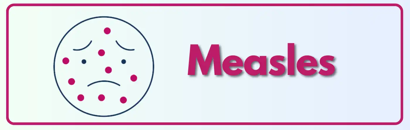 Measles