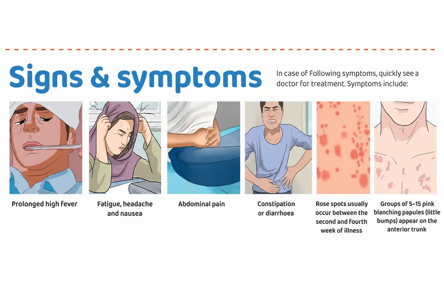 Typhoid fever signs and symptoms