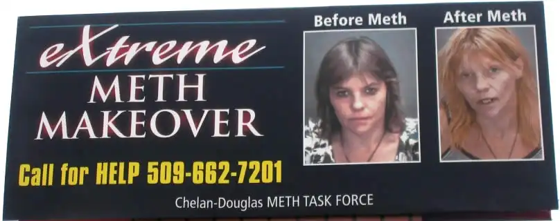 Methamphetamine before and after